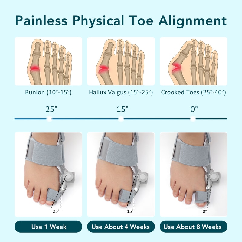 Adjustable Bunion Corrector Toe Straightener For Pain Relief And Hallux Valgus Support 1