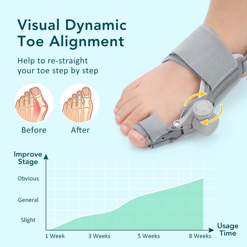 Adjustable Bunion Corrector Toe Straightener For Pain Relief And Hallux Valgus Support 4