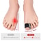 Silicone Bunion Corrector Toe Straightener Soft Hallux Valgus Brace For Daily Foot Alignment Pain 2