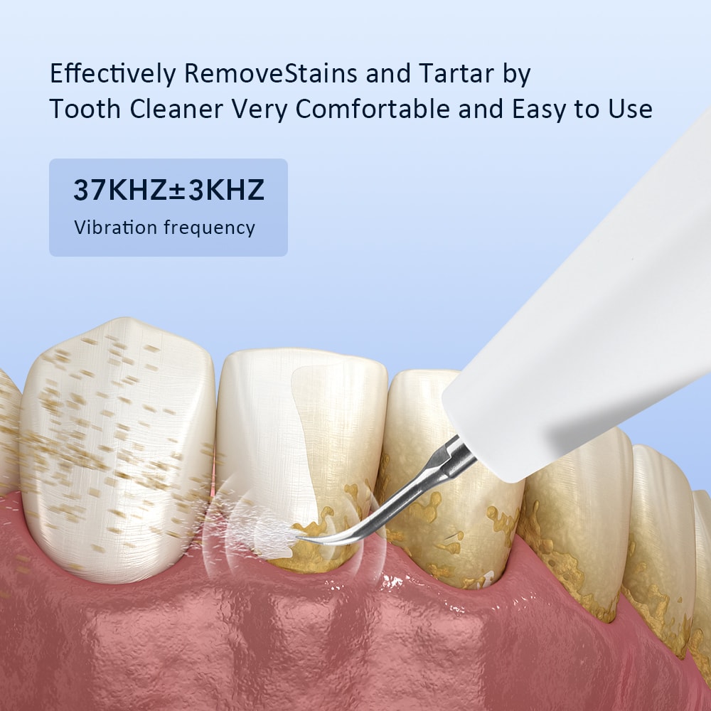 Ultrasonic Teeth Cleaner Scaler For Plaque Removal And Whitening 2