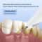 Ultrasonic Teeth Cleaner Scaler For Plaque Removal And Whitening 2