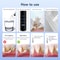 Ultrasonic Teeth Cleaner Scaler For Plaque Removal And Whitening 4