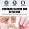 Advanced Nail Fungus Treatment Pen For Toenail Infection Repair And Brightening Care 5