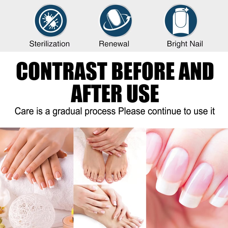 Advanced Nail Fungus Treatment Pen For Toenail Infection Repair And Brightening Care 5