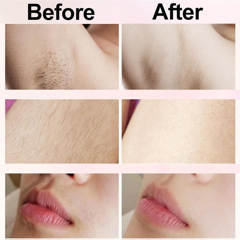 Precision Electric Razor for Women Facial & Body Hair Remover Bikini Trimmer