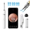 Smart Visual Ear Cleaner Camera Kit with HD Ear Wax Removal Tool & Precision Tweezers