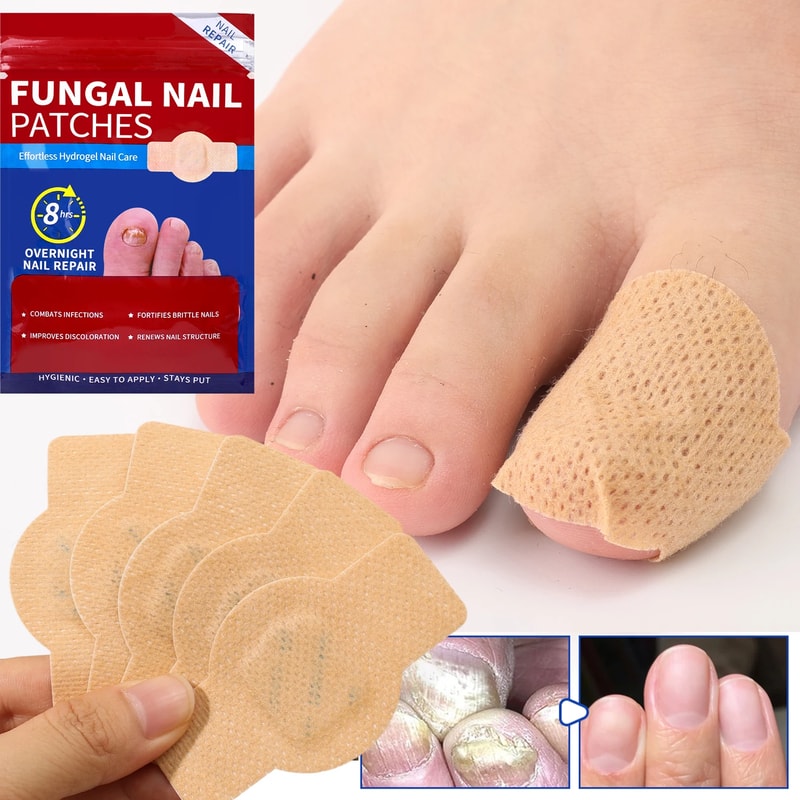 Advanced Nail Fungus Treatment Patches For Ingrown Toenail Repair Healthy Nail Recovery 0