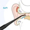 Silicone Spiral Ear Cleaner Tool Safe Soft Tip Earwax Removal Kit 3