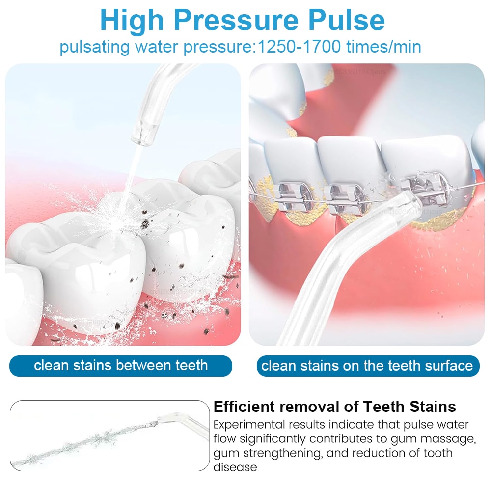 Advanced Water Flosser Oral Irrigator High Pressure Teeth Cleaner with Tips