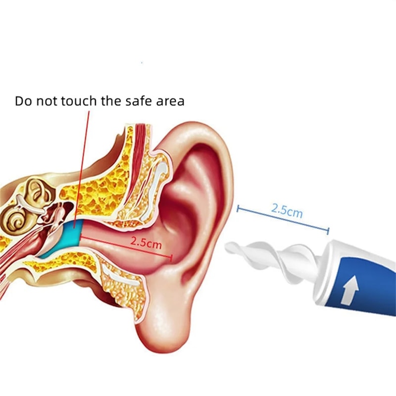 Piece Ear Cleaning Kit With Soft Spiral Tips Portable Ear Wax Removal Tool Set 5