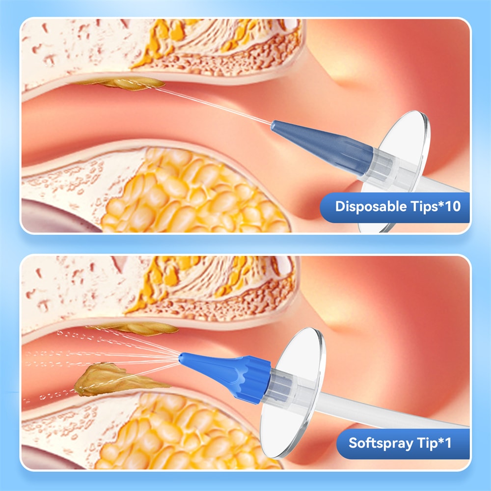 Advanced Ear Irrigation Cleaning Kit for Safe ear wax removal and Gentle ear cleaning kit Use