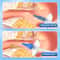 Advanced Ear Irrigation Cleaning Kit for Safe ear wax removal and Gentle ear cleaning kit Use