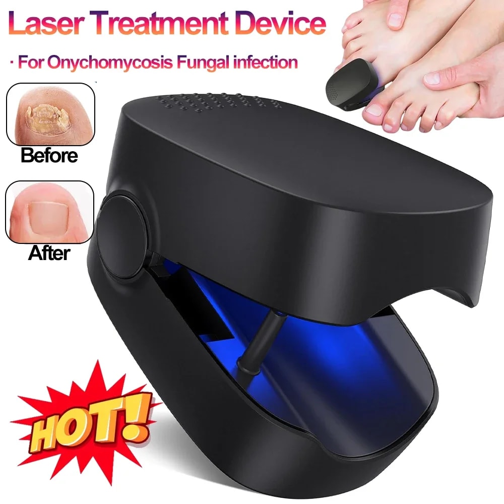 Laser Nail Fungus Treatment Device With Blue Light Therapy USB Rechargeable Onychomycosis Care 0