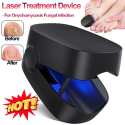 laser nail fungus treatment device with blue light therapy usb rechargeable onychomycosis care