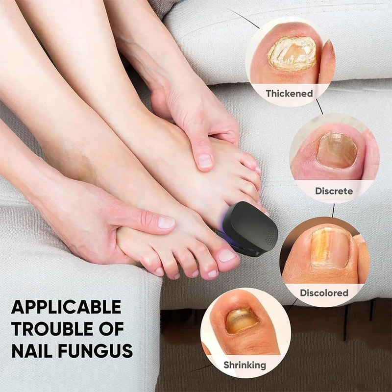 Laser Nail Fungus Treatment Device With Blue Light Therapy USB Rechargeable Onychomycosis Care 3