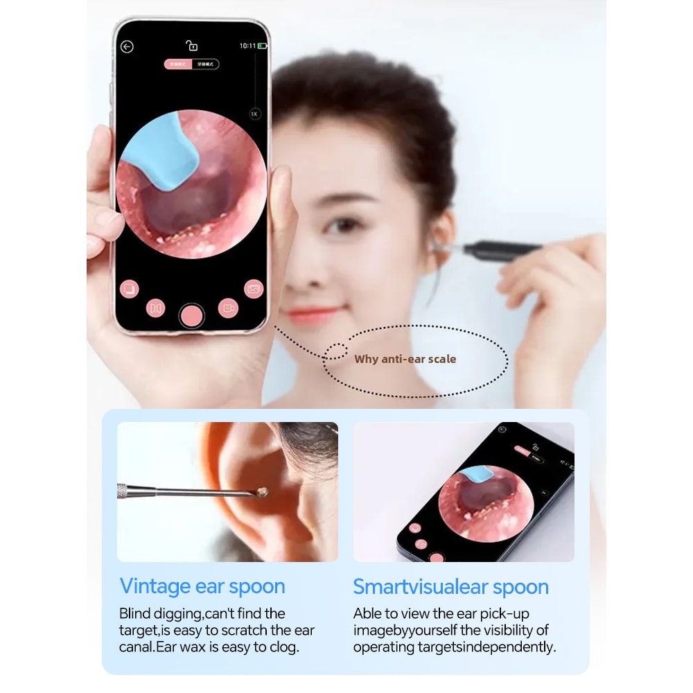 Smart HD Ear Cleaner Camera With LED Light Visual Earwax Removal Tool 2