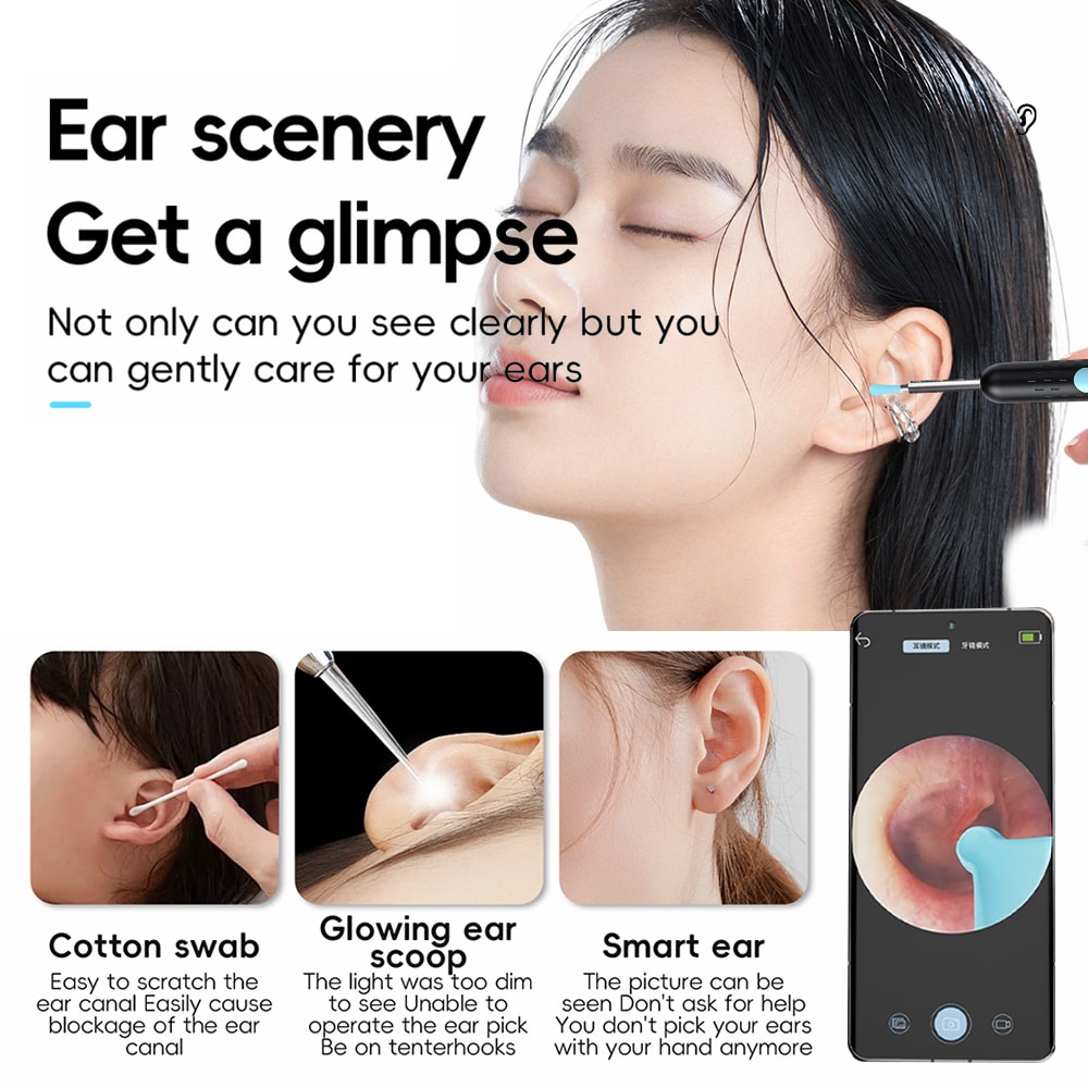 HD Smart Ear Wax Removal Camera Kit with WiFi & LED Lights