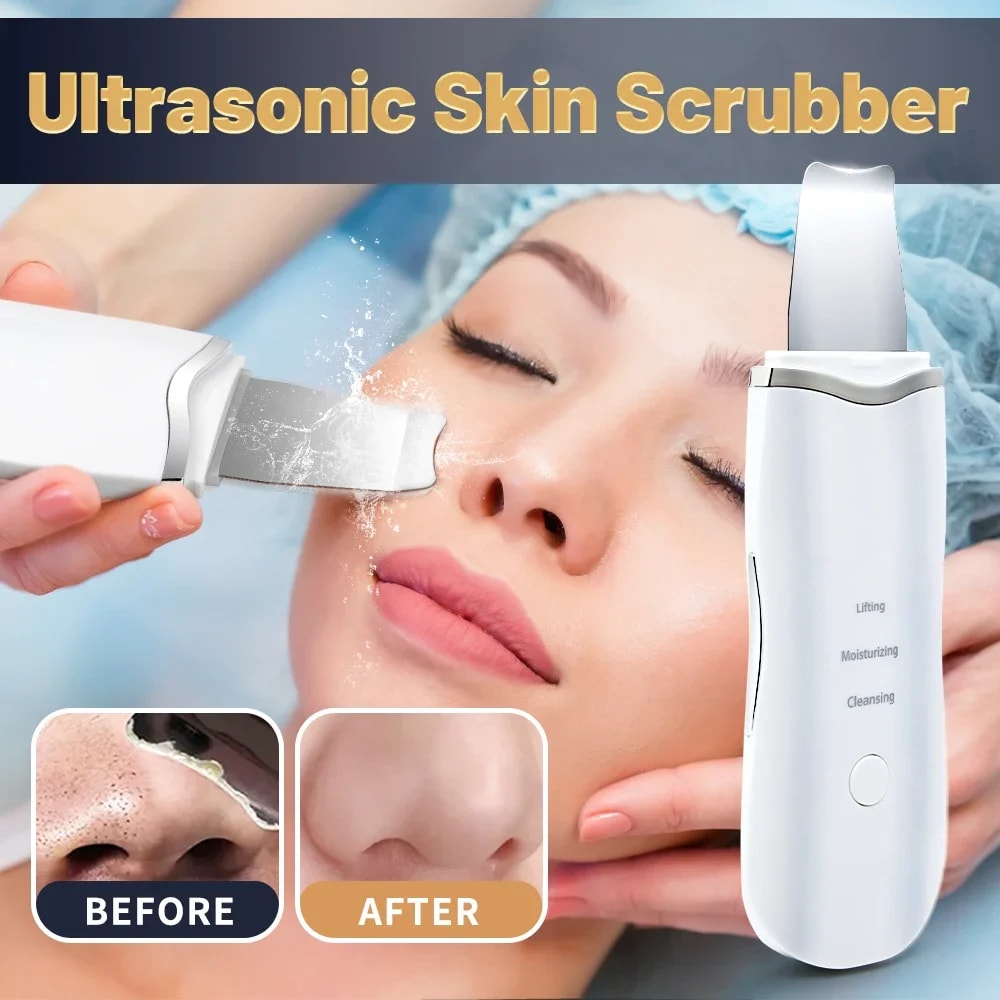Ultrasonic Skin Scrubber Facial Spatula Deep Pore Cleansing Ion Peeling Device 1