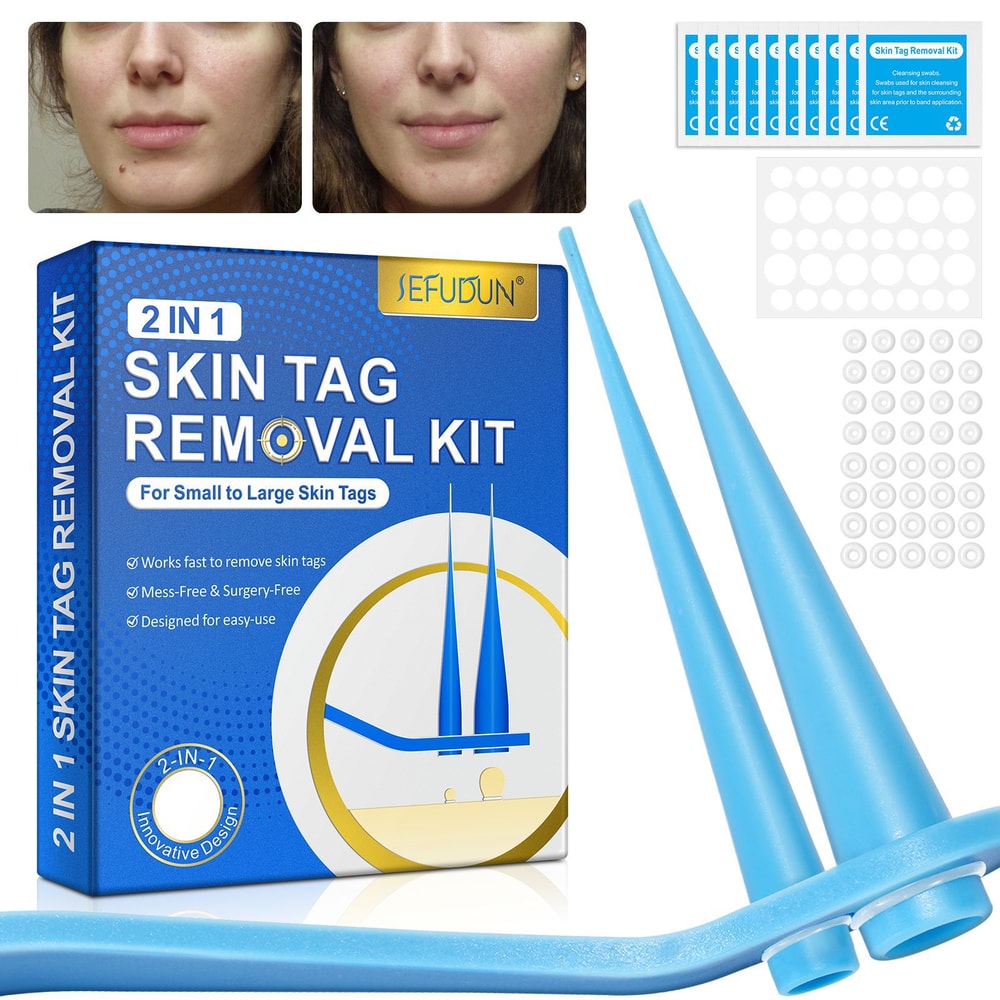 SmoothClear Skin Tag Mole Removal Kit Painless Skin Tag Remover For Home Use 1