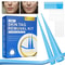 SmoothClear Skin Tag Mole Removal Kit Painless Skin Tag Remover For Home Use 1