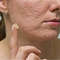 TCM Acne Scar Cream (7).jpg