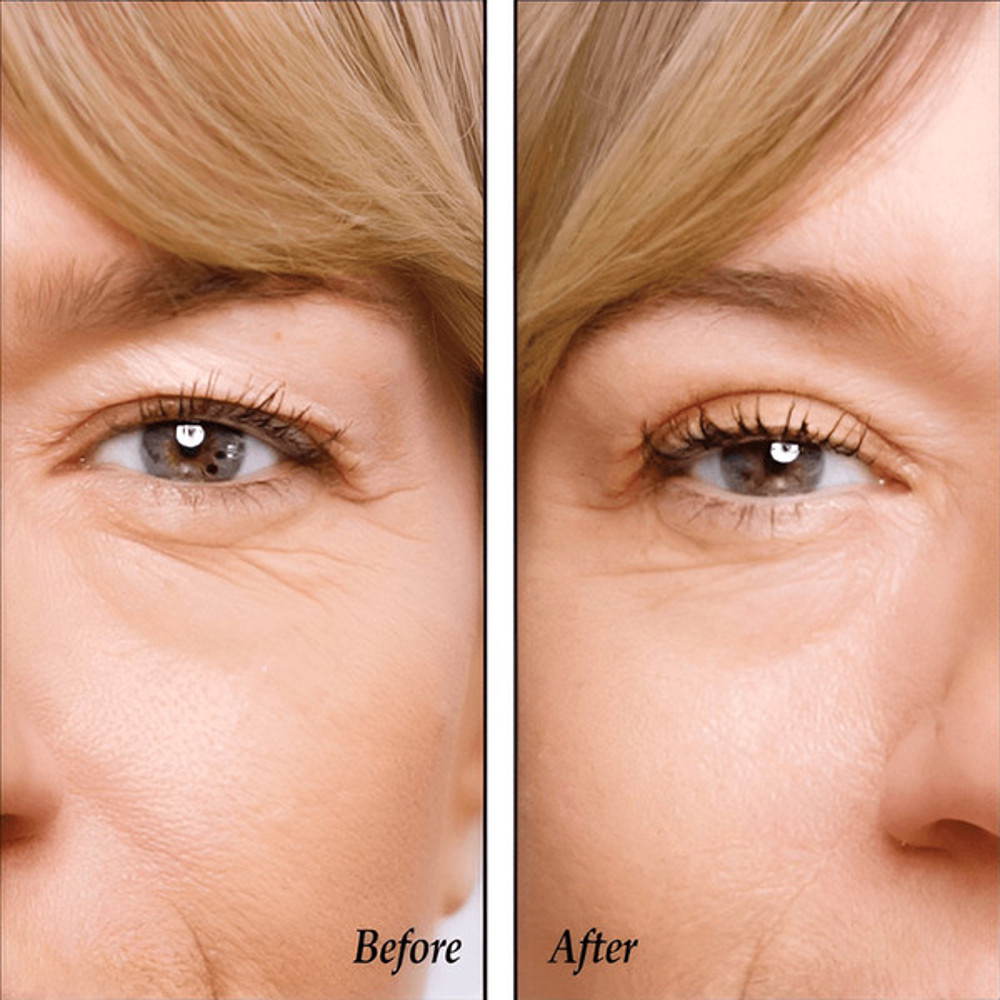 Eyelid Lifters Tape (6).jpg