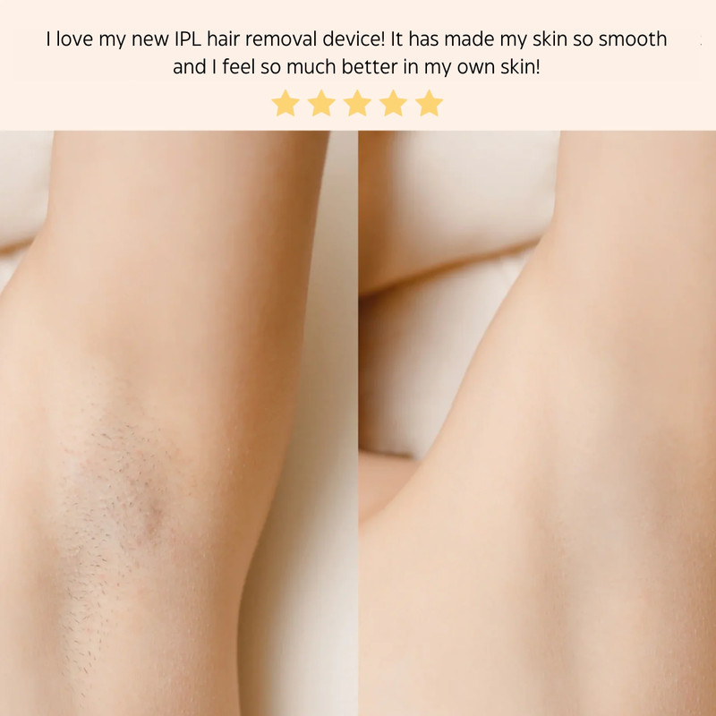 IPL Laser Hair Removal Handset System 6