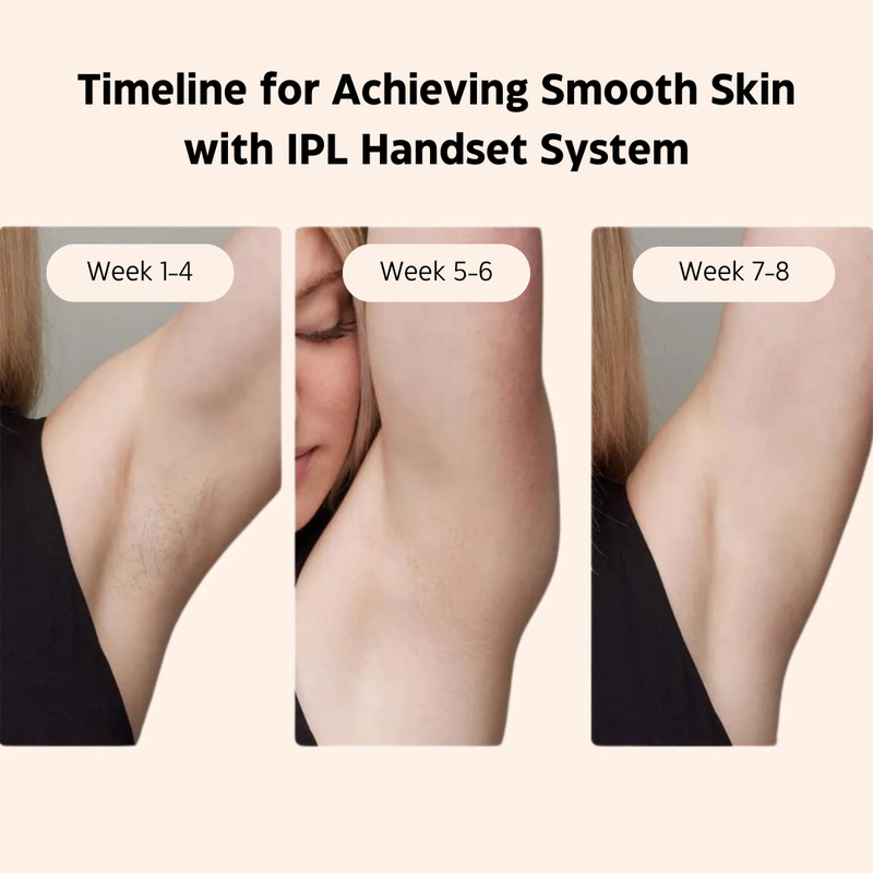IPL Laser Hair Removal Handset System 4