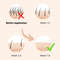 IPL Laser Hair Removal Handset System 7