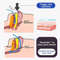 Anti Snoring Sticker For Better Sleep Improve Mouth Breathing With Nighttime Sleep Mouth Correction