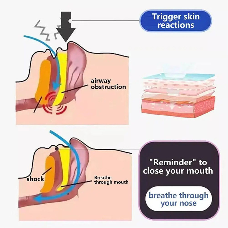 Anti Snoring Sticker For Better Sleep Improve Mouth Breathing With Nighttime Sleep Mouth Correction