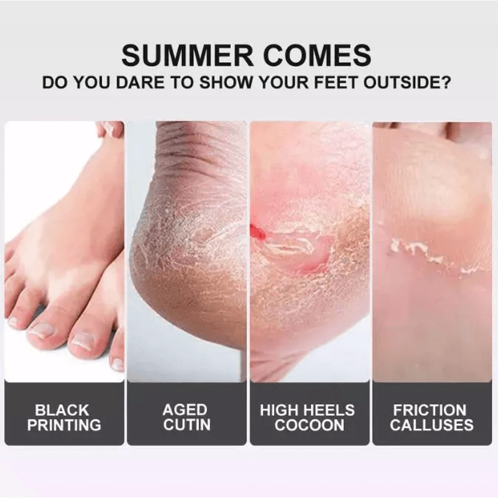 Exfoliating Foot Peel Mask For Baby Soft Feet Callus Remover Socks To Remove Dead Skin Cracked Hee 4