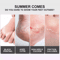 Exfoliating Foot Peel Mask For Baby Soft Feet Callus Remover Socks To Remove Dead Skin Cracked Hee 4