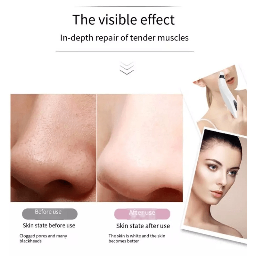 Electric Blackhead Remover Cleaner Face Diamond Pore Vacuum With Whitehead Suction Tool 2