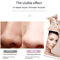 Electric Blackhead Remover Cleaner Face Diamond Pore Vacuum With Whitehead Suction Tool 2