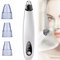 Electric Blackhead Remover Cleaner Face Diamond Pore Vacuum With Whitehead Suction Tool 0