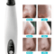 Electric Blackhead Remover Cleaner Face Diamond Pore Vacuum With Whitehead Suction Tool 3