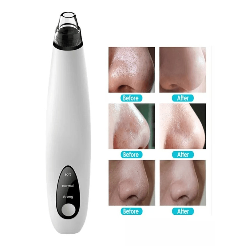 Electric Blackhead Remover Cleaner Face Diamond Pore Vacuum With Whitehead Suction Tool 3