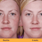 Kojic Acid Skin Whitening Serum Ultra Brightening Dark Spot Corrector With Niacinamide  Vitamin C 1