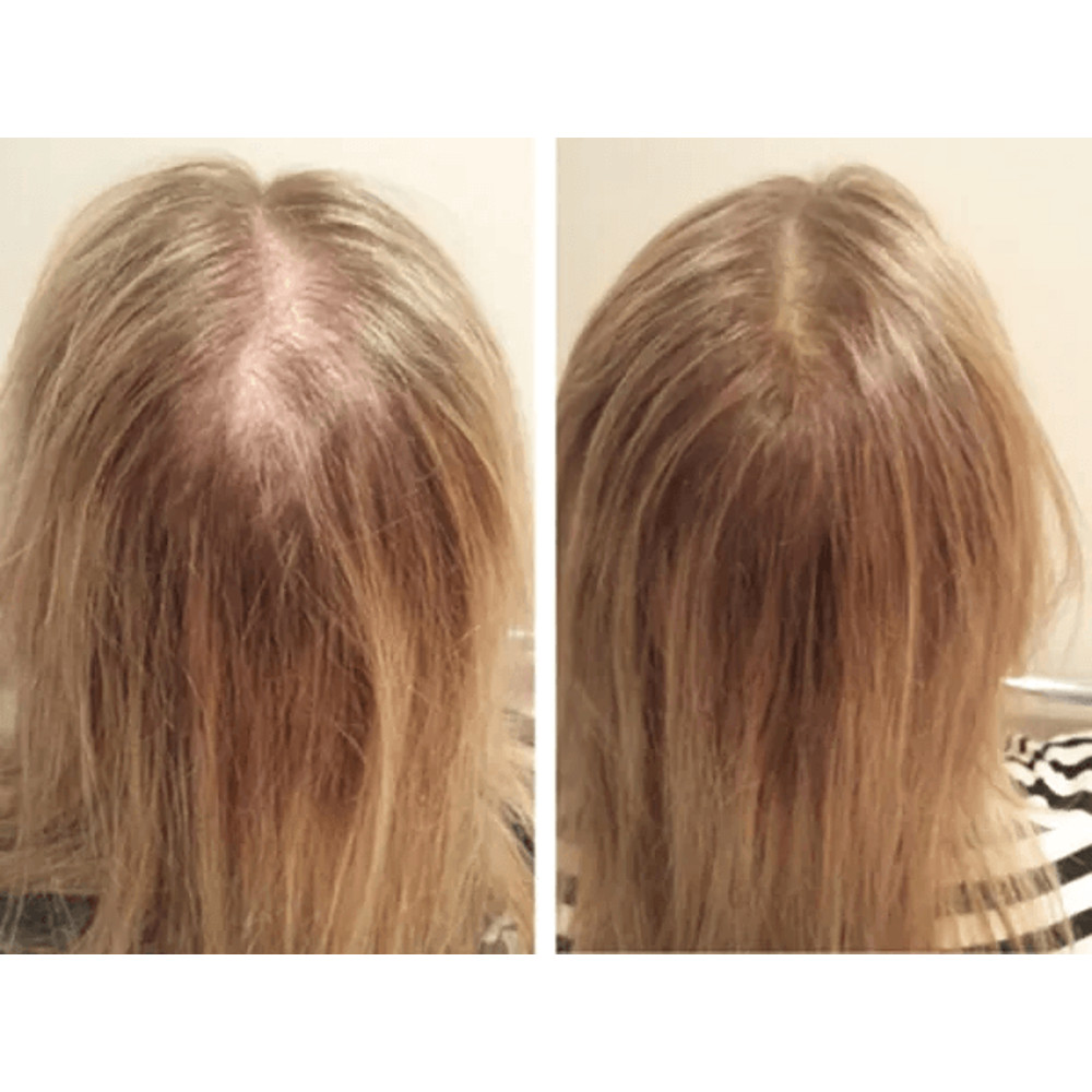 Best Fastest Hair Loss ReGrowth AntiThinning Shampoo 16 Organic Oils For Men  Women 2