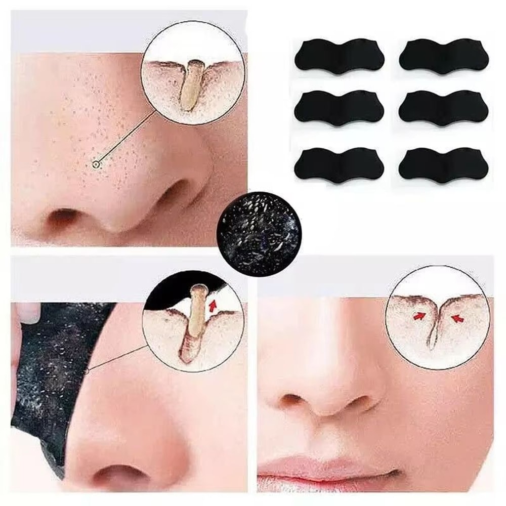 Nose Blackhead Removal Sticker Strips 0