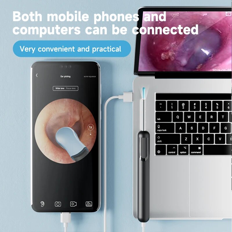 Ear Wax Removal Tool Smart Ear Cleaner With Light HD Camera Scope For Smartphones 4