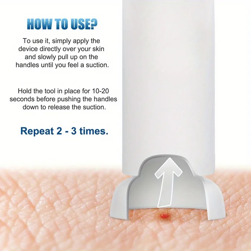 Bug Bite Extractor Tool For Mosquito And Bee Stings Emergency Venom Suction Tool For Outdoor Advent