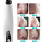 Electric Blackhead Remover Diamond Pore Vacuum Suction With White Heads For Clear Smooth Skin 7