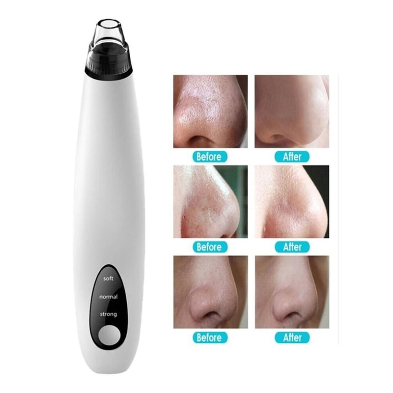 Electric Blackhead Remover Diamond Pore Vacuum Suction With White Heads For Clear Smooth Skin 7