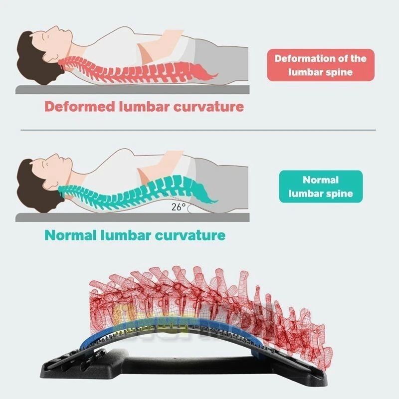MultiLevel Back Stretcher Lumbar Support Device Pain Relief Posture Aid For Spine Health 3