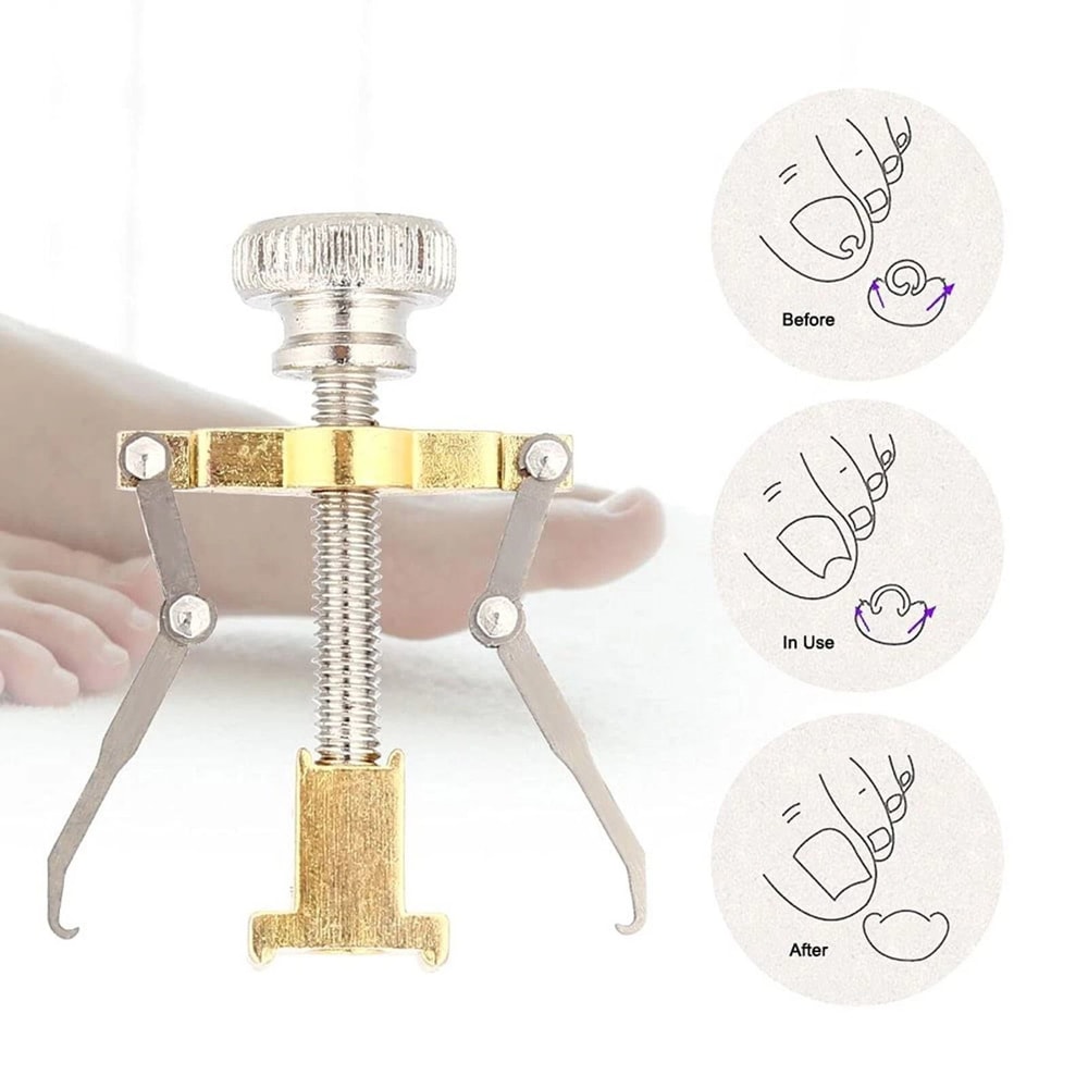 Ingrown Toenail Correction Lifter Tool Fixer For Toenail Straightening And Ingrown Toenail Treatme