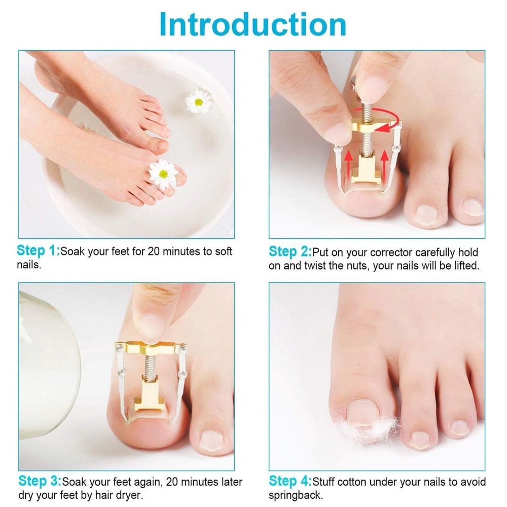 Ingrown Toenail Correction Lifter Tool Fixer For Toenail Straightening And Ingrown Toenail Treatme