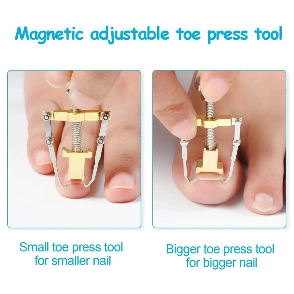 Ingrown Toenail Correction Lifter Tool Fixer For Toenail Straightening And Ingrown Toenail Treatme