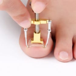 ingrown toenail correction lifter tool - fixer for toenail straightening and ingrown toenail treatment